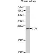 CD9 Antigen (CD9) Antibody