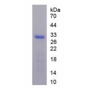 Mouse Complement C4-B (C4B) Protein