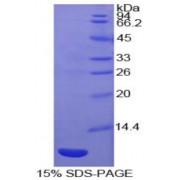 Human C-C Motif Chemokine 20 / MIP3A (CCL20) Protein