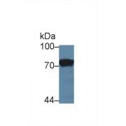 Prothrombin Fragment 1+2 (F1+2) Antibody