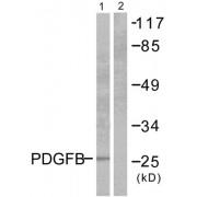Platelet Derived Growth Factor Subunit B (PDGFB) Antibody