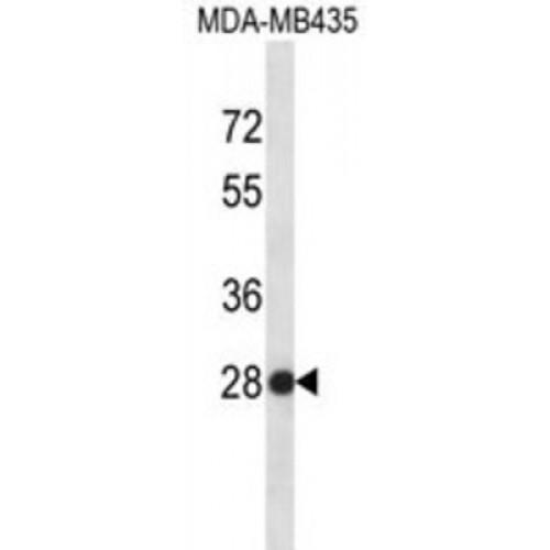 Small Nuclear Ribonucleoprotein Polypeptide B2 (SNRPB2) Antibody
