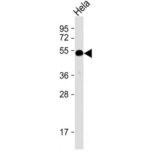 Serine Protease HTRA1 (HTRA1) Antibody