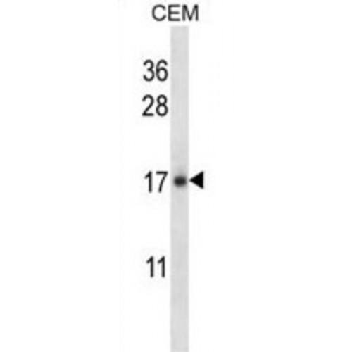 Interleukin 21 (IL21) Antibody