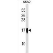 C-C Motif Chemokine 7 (CCL7) Antibody
