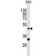 AlkB Homolog 5, RNA Demethylase (ALKBH5) Antibody
