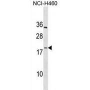 Platelet Factor 4 Variant 1 (PF4V1) Antibody