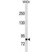 Dipeptidyl Peptidase 4 / CD26 (DPP4) Antibody
