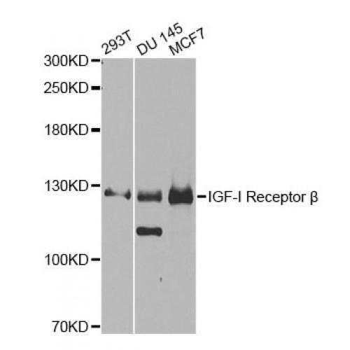 Insulin Like Growth Factor 1 Receptor (IGF1R) Antibody
