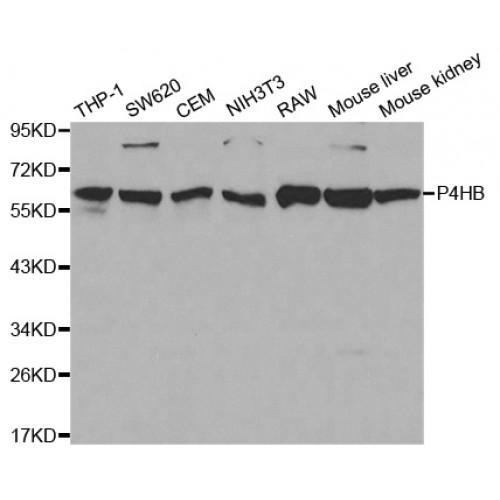 Protein Disulfide-Isomerase (P4HB) Antibody