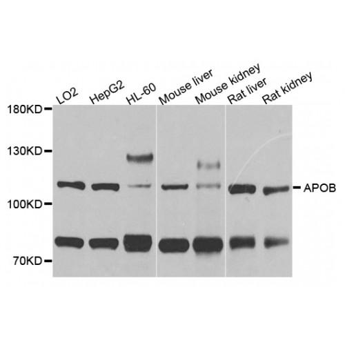 Apolipoprotein B (APOB) Antibody