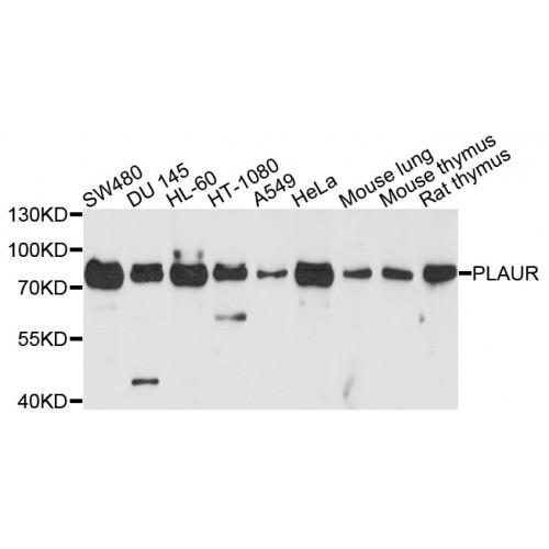 Urokinase Plasminogen Activator Surface Receptor / uPAR / CD87 (PLAUR) Antibody