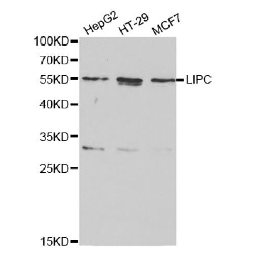 Hepatic Triacylglycerol Lipase (LIPC) Antibody