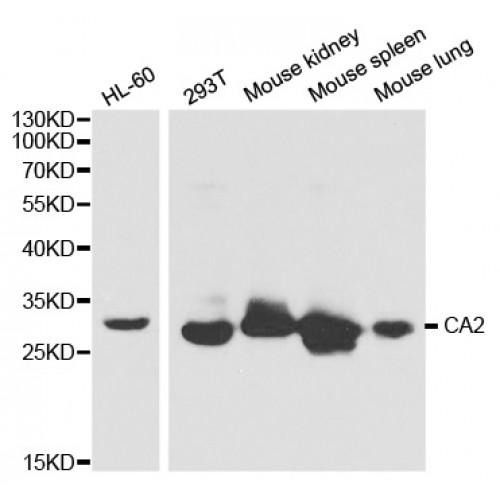 Carbonic Anhydrase II (CA2) Antibody