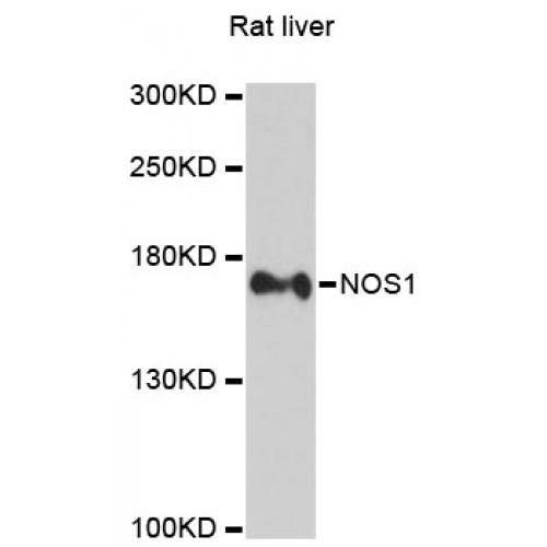 Nitric Oxide Synthase, Brain (NOS1) Antibody