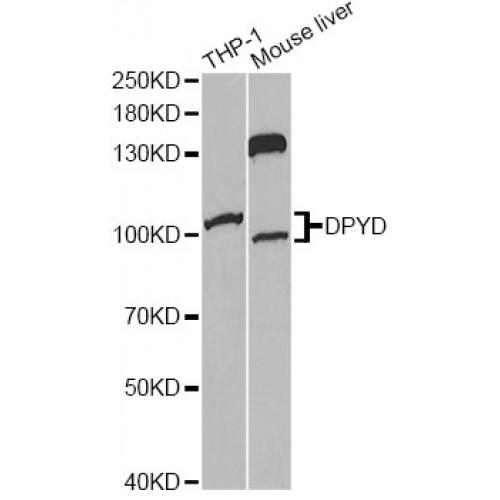 Dihydropyrimidine Dehydrogenase (DPYD) Antibody