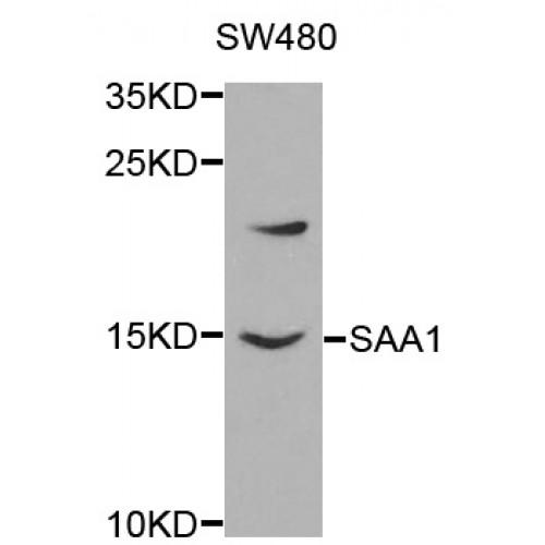 Serum Amyloid A-1 Protein (SAA1) Antibody