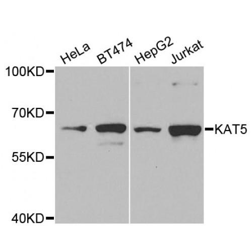 Lysine Acetyltransferase 5 (KAT5) Antibody