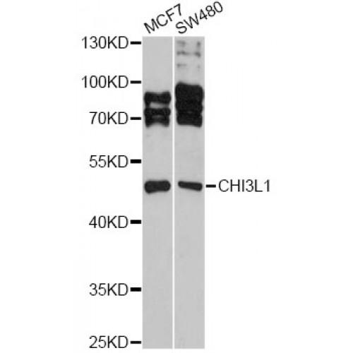 Chitinase-3-Like Protein 1 (CHI3L1) Antibody