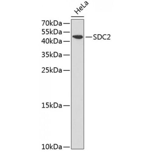 Syndecan 2 (SDC2) Antibody