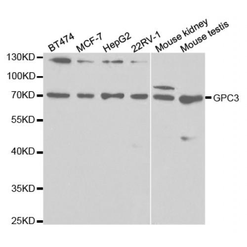 Glypican 3 (GPC3) Antibody