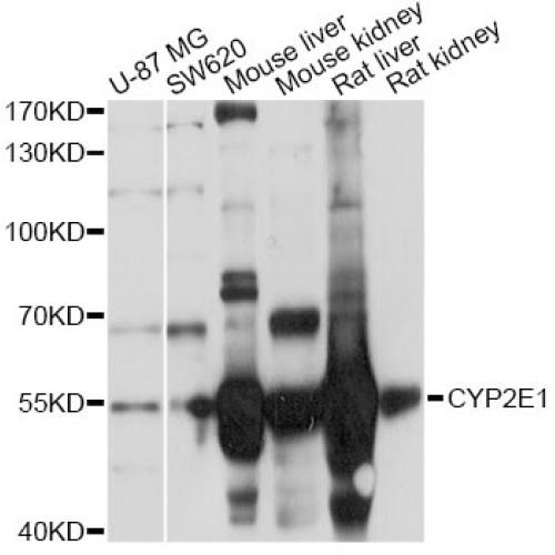 Cytochrome P450 2E1 (CYP2E1) Antibody