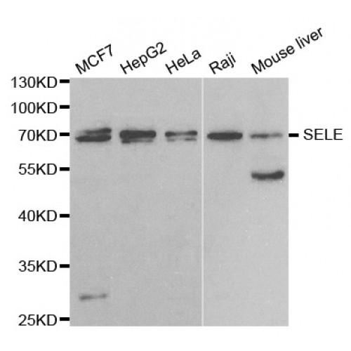 E-Selectin / CD62E (SELE) Antibody