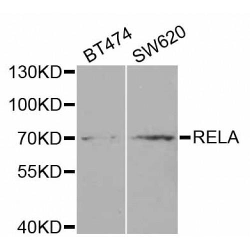 V-Rel Reticuloendotheliosis Viral Oncogene Homolog A (RELA) Antibody