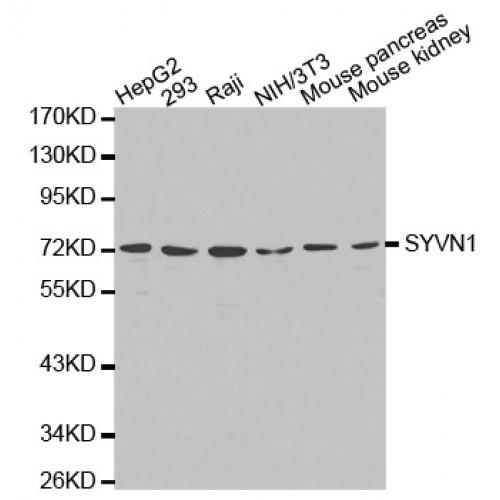 E3 Ubiquitin-Protein Ligase Synoviolin (SYVN1) Antibody