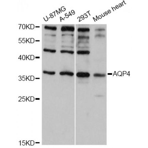 Aquaporin 4 (AQP4) Antibody