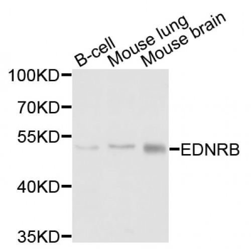 Endothelin Receptor Type B (EDNRB) Antibody