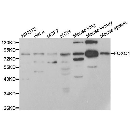 Forkhead Box Protein O1 (FOXO1) Antibody