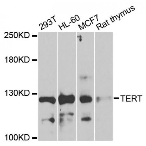 Telomerase Reverse Transcriptase (TERT) Antibody