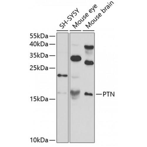 Pleiotrophin (PTN) Antibody