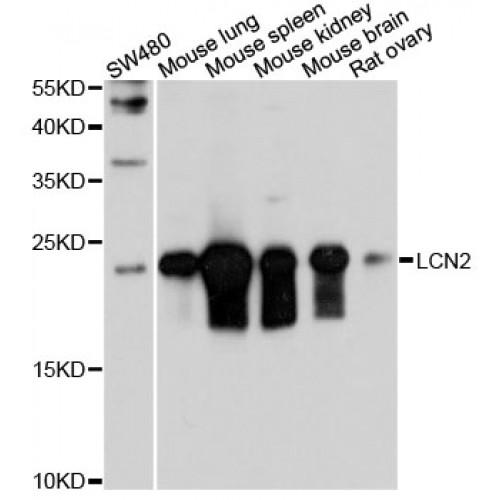 Neutrophil Gelatinase Associated Lipocalin / NGAL (LCN2) Antibody