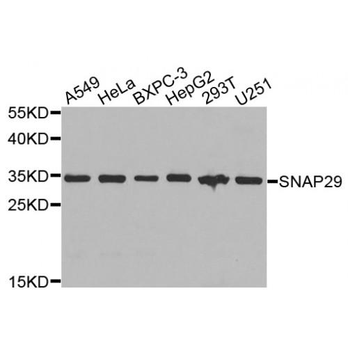 Synaptosome Associated Protein 29 (SNAP29) Antibody