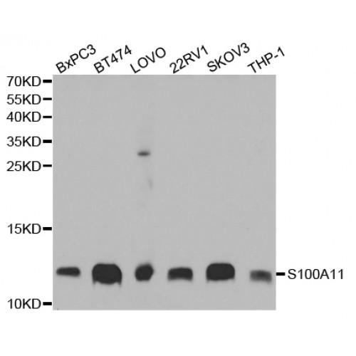 S100 Calcium Binding Protein A11 (S100A11) Antibody