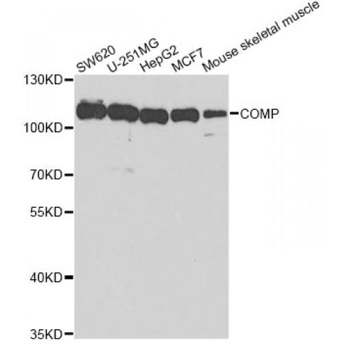 Cartilage Oligomeric Matrix Protein (COMP) Antibody