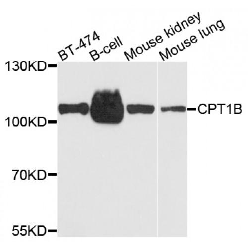 Carnitine Palmitoyltransferase 1B, Muscle (CPT1B) Antibody