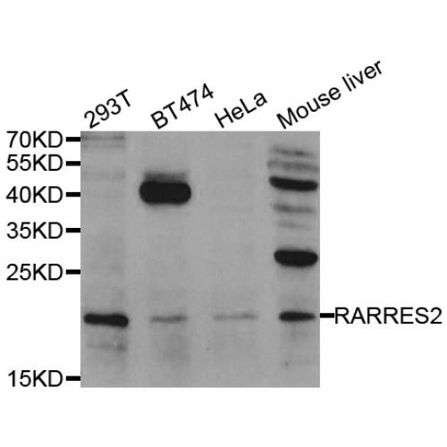 Retinoic Acid Receptor Responder Protein 2 (RARRES2) Antibody