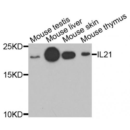 Interleukin 21 (IL21) Antibody