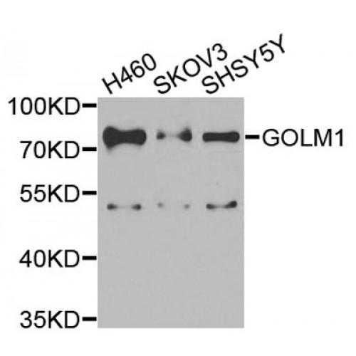 Golgi Membrane Protein 1 (GOLM1) Antibody