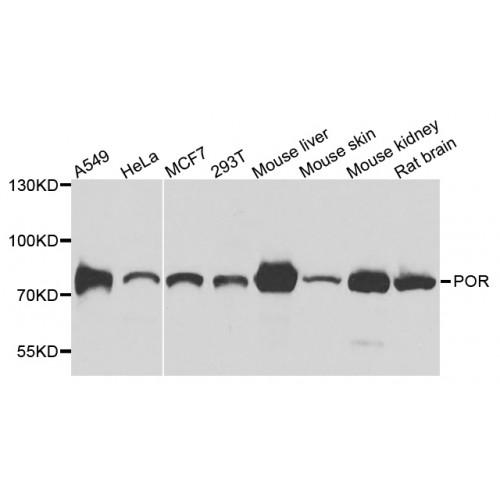 NADPH-Cytochrome P450 Reductase (POR) Antibody