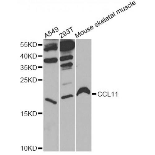 Eotaxin 1 (CCL11) Antibody