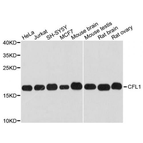 Cofilin 1 (CFL1) Antibody