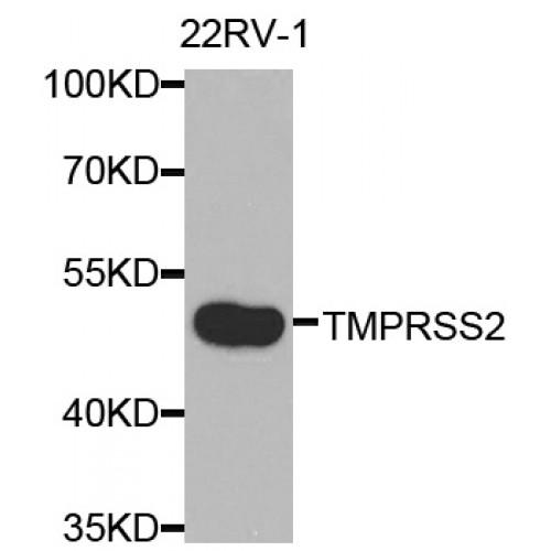 Transmembrane Protease, Serine 2 (TMPRSS2) Antibody