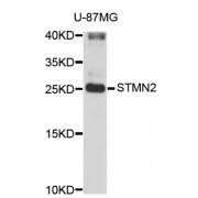 Stathmin 2 (STMN2) Antibody