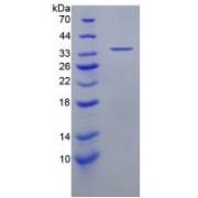 Human C-X-C Motif Chemokine 5 / ENA-78 (CXCL5) Protein