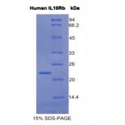 Human Interleukin 10 Receptor Beta (IL10Rb) Protein