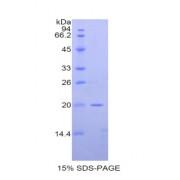 Mouse Protein O-GlcNAcase / MGEA5 (OGA) Protein